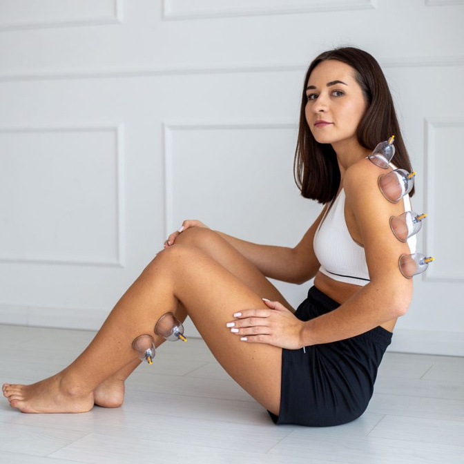 Ventuze din plastic Acus Med în valiză – set de 20 de bucăți