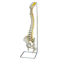 Model al unei coloane vertebrale umane cu hernie de disc, 80 cm