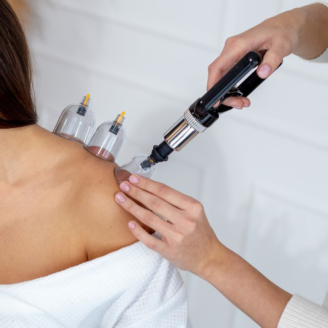 Ventuze din plastic Acus Med în valiză – set de 20 de bucăți